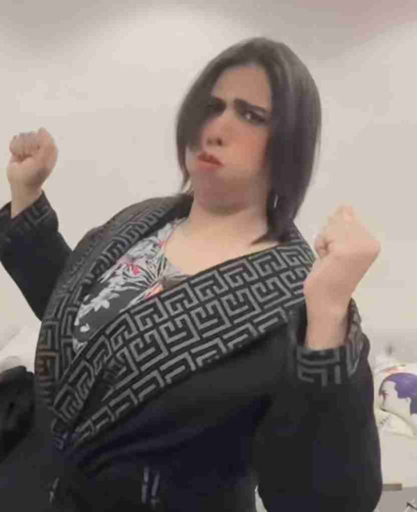 ريم البلوشي قبل وبعد